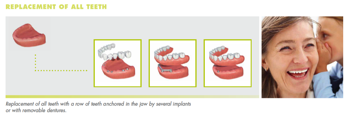 Dental replacement procedure showing three steps of tooth restoration with smiling patient photo.