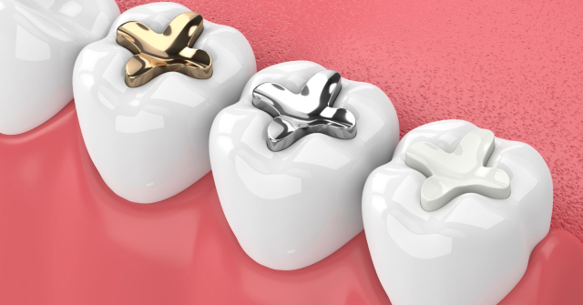 Three white tooth models on pink background displaying dental filling and crown treatment options.