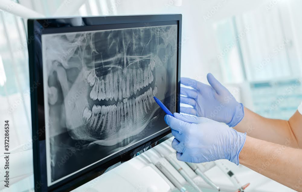 montclair dentists answers if dental xrays are safe or not